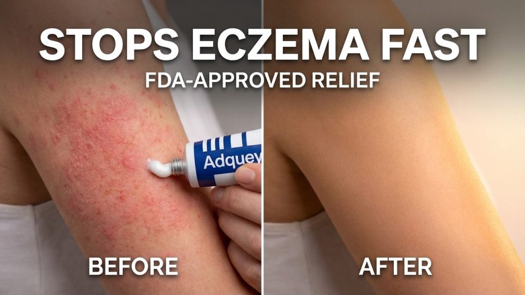 Adquey Ointment: How It Stops Eczema Fast!